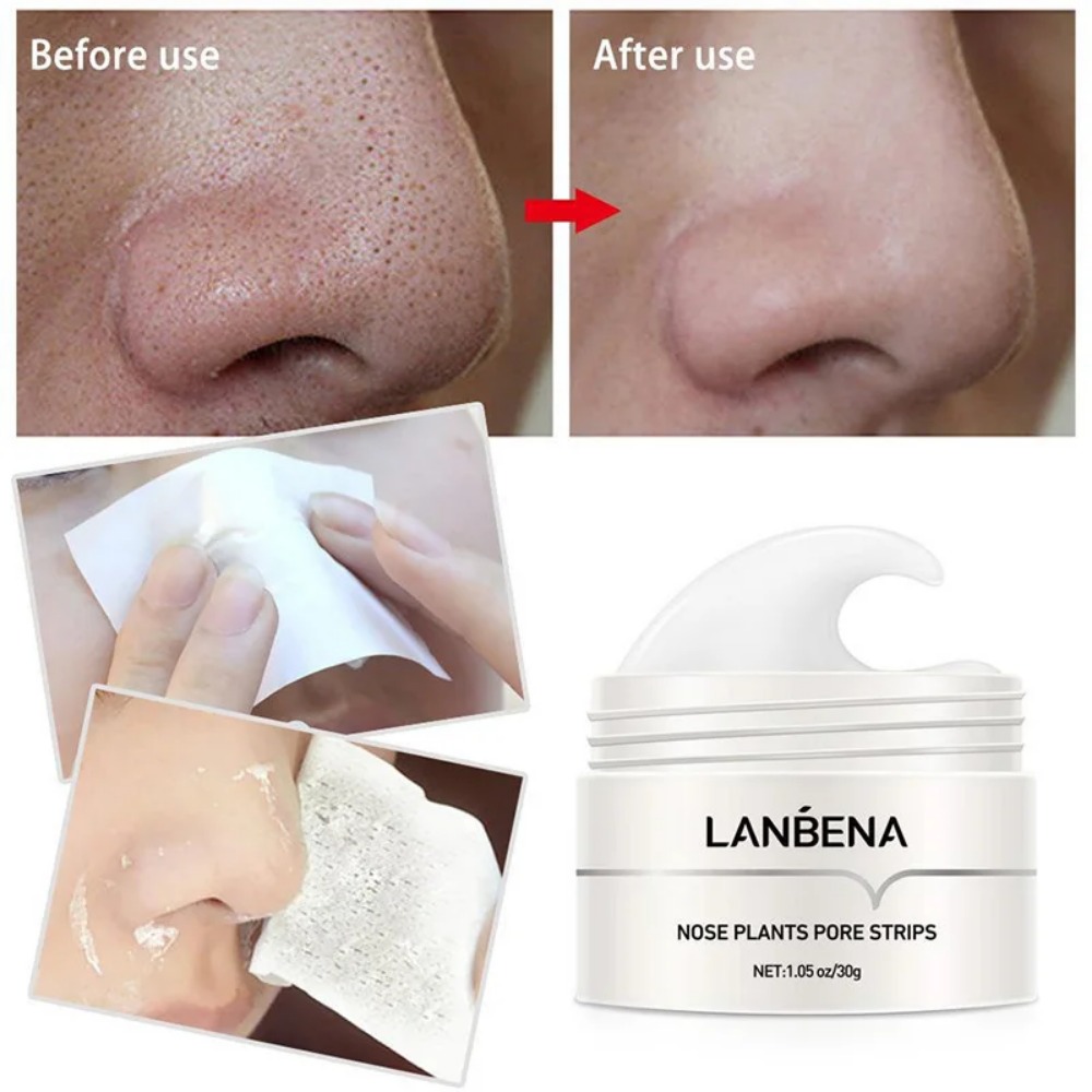 Nose Blackhead Remover Cream P – обзор и цена Black Face Mask Pack
